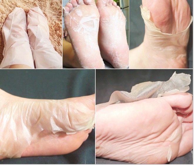 thick foot skin thick foot skin