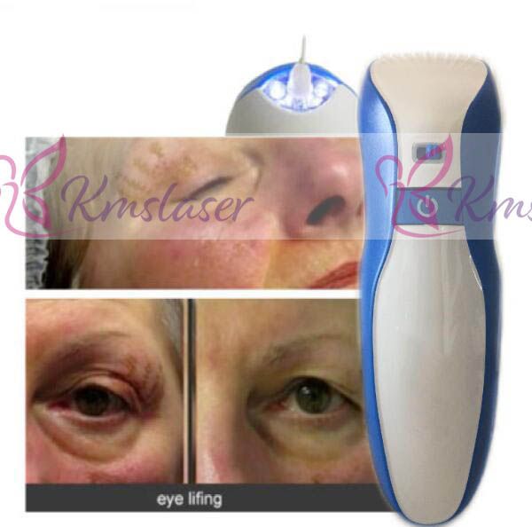 New 2018 4needles Portable Laser Plasma Pen Eyebrow Lift Pen Spot Removal Pen Plasma Pen Wrinkle Removal Beauty