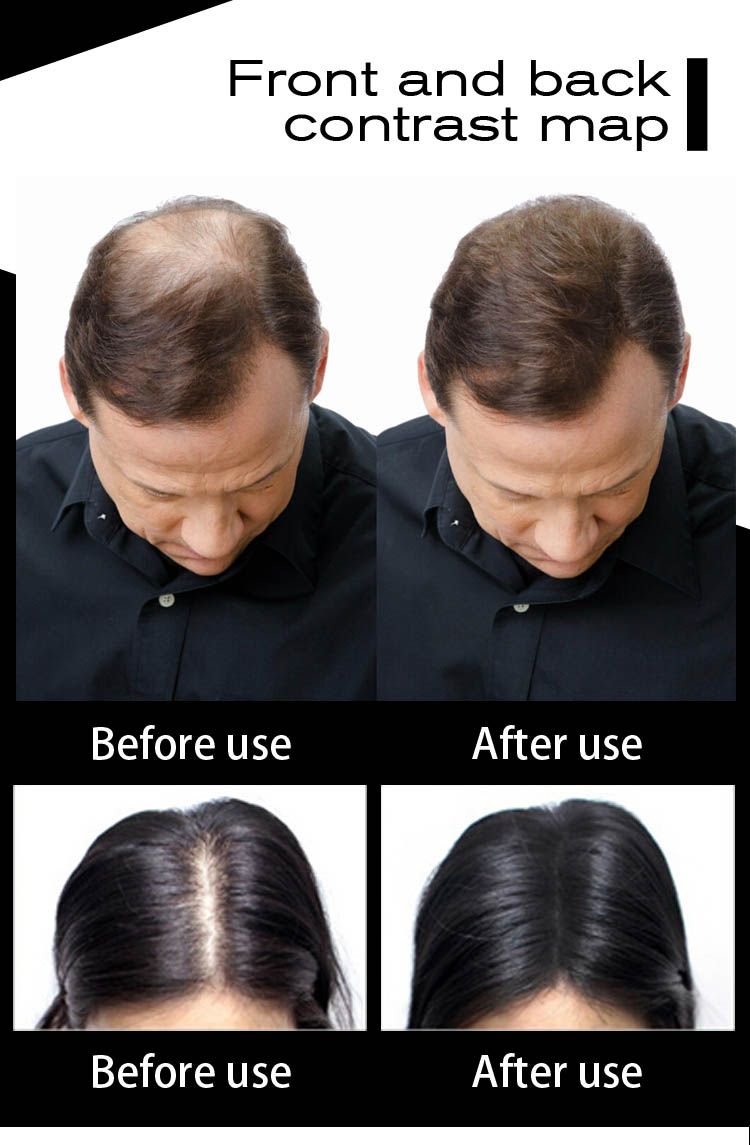 Spray Applicator Protein Hair Thickening Fibers Building Keratin