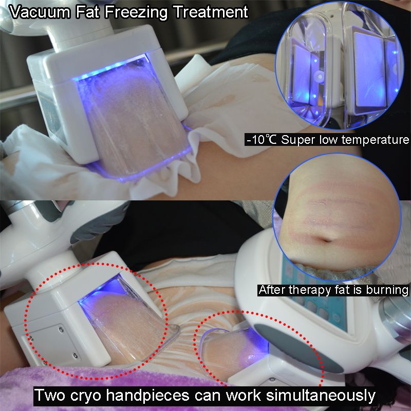Does Cryotherapy Work For Fat Loss