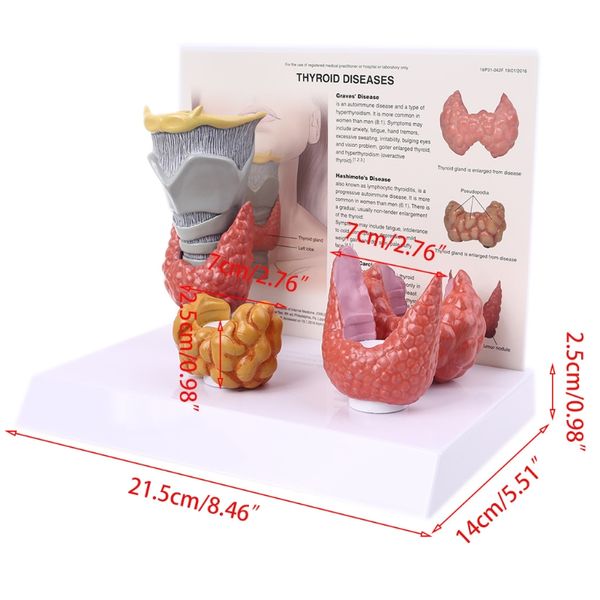1 Establecer a tamaño natural Anatómico Anatómico de la glándula tiroides Patología Anatomía Sistema digestivo Mostrar herramienta de estudio de estudio de diseño vívido