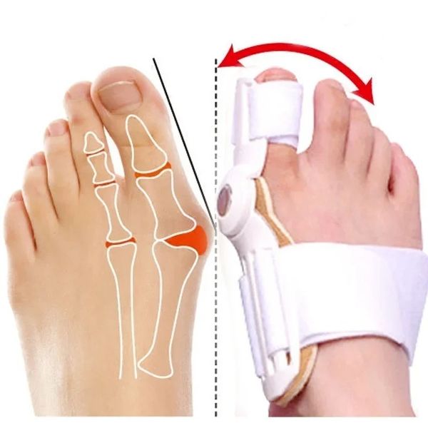 1PAIR = 2pcs Hallux Valgus STRIPUS BIG TOE BUNION BUNION Corrector Corrector Pedicura Pedicura Separador Corrector para dedos de los pies para los dedos de los pies