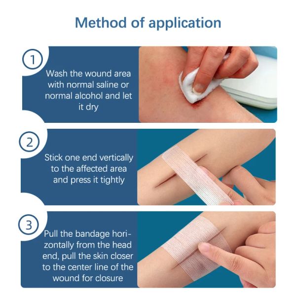 1set Bandle Bandable Bandage imperméable Plai des premiers soins Vêtements médicaux Médicaux de basse en plâtrice