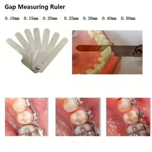 Règle de mesure interproximale dentaire, 1 ensemble, mesure de l'écart dentaire, système IPR alternatif en acier inoxydable, traitement orthodontique