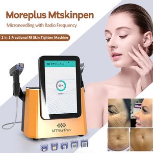 2 In 1 RF Microneedle Beauty Machine Facial Lifting Stretch Mark Acne Wrinkle Removal Skin Trachering Radio Frequentie Beauty Equipment 5 Tips CE -certificering