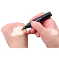 Vitiligo Concealer Covering Liquid Pen Waterproof Vitiligo White Spots Long-Lasting Leukoderma Instant Makeup for Skin Discolored 238Y