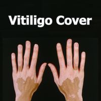 Solución Covering Vitiligo Corrector Pluma líquida impermeable Vitiligo Parches Natural Ocultar Leucoderma instantánea de maquillaje para la piel 1pc Enfermedad
