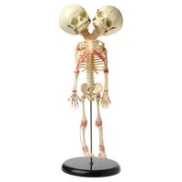 Wholesale 37cm Human Double Head Baby Skull Skeleton Anatomy Brain Display Study Teaching Anatomical Model Halloween Bar Ornament