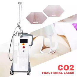 De meeste RF -apparatuur populaire verticale CO2 fractionele laser striae verlichting huid Verjongingsfractioneel