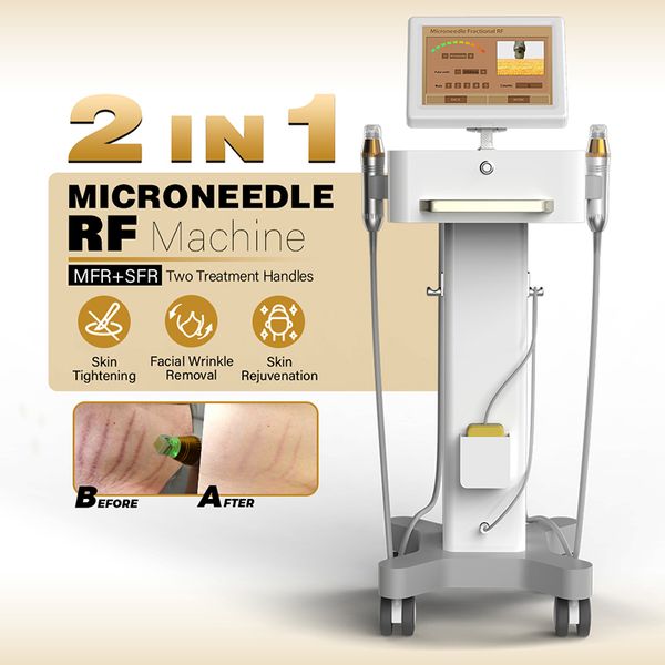 2023 Máquina profesional con microagujas RF Dispositivo de mesoterapia Consejos Vertical Blanqueamiento de la piel Levantamiento Aguja RF Microaguja Microaguja Máquina de radiofrecuencia