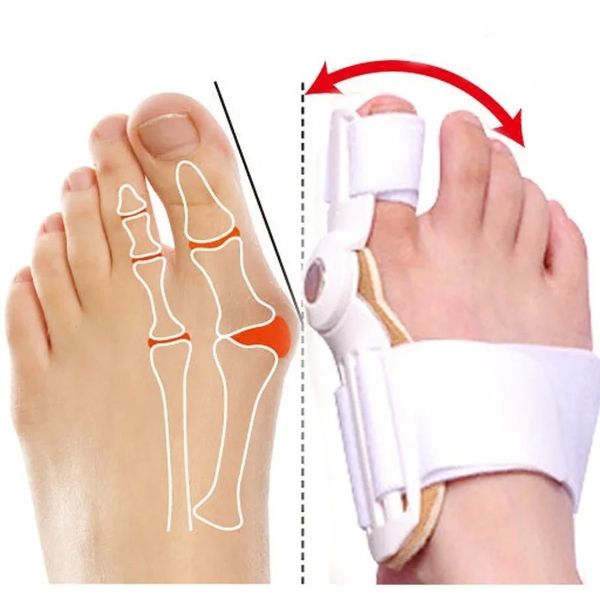 2024 1pair = 2pcs Hallux Valgus Sageur Big Toe Bunion Splint Correcteur Correcteur Foot Pédicure séparateur Toes Correcteur pour les orteils