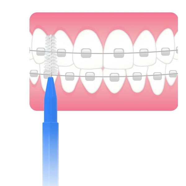 2024 30pcs/set I Cepillo interdental en forma de limpieza interdental de flosss ortodoncia dental dental pincel de cuidados oral