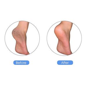2024 Naturel Pumpice Stone Foot Stone Netter Sket Griding Callus Foot Care Massage Tool Plean Dead Dreigh Skin Care Callus Remover For Foot