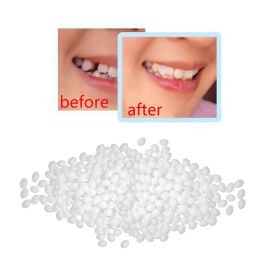25/50 g Tijdelijke tandreparatie kralen ontbreken gebroken tanden vulmateriaal Voedsel Grade valse tanden vaste lijm Debures lijm