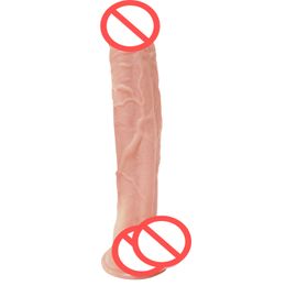 Huge Black Dildo Realistic Big Dick Penis Imitator For Sex Female Falos Masturbation Device Silicone Wear Adult Toys