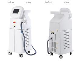 Stationary diode laser 808nm Laser Best Painless Soporano Laser Hair Removal Machine 808 Diode Water cooling and air cooling syste