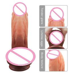 NXY Dildos Adult Large Suction Cup Penis, Female Real G-spot Stimulation, Anal Masturbation Device, Silicone Sex Toy, 181213
