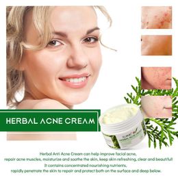 Cream Improve Closed Mouth Moisturize Safety Repair Skin Treatment Fade Spots Oil Control Shrink Bath Brushes, Sponges & Scrubbe Scru Scrubb