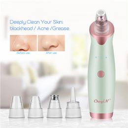 Blackhead Remover Vacuum Suction Electric Facial Pore Cleanser Acne Comedone Extractor Tool with 5 Probes Multifunctional Beauty