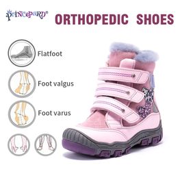 PrincePard 100% Doğal Kürk Hakiki Deri Ortopedik Ayakkabı Erkek Kızlar için 22-36 Boyutu Yeni Kış Ortopedik Çizmeler Çocuklar Için 210329