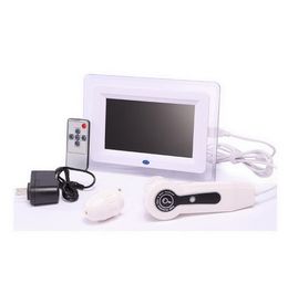 Digital skin analyzer hair scalp camera with usb scalp detector machine