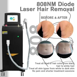 2022 Newest Design Vertical Kind 808nm Diode Laser Hair Removal Machine Removal Permanent Equipment