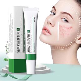 creams for anti aging UK - Retinol Face Cream Firming Lifting Anti-Aging Remove Wrinkles Fine Lines Whitening Brightening Moisturizing Facial Skin Care 20g