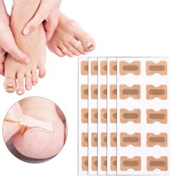 100pcs/set Nail Correction Stickers Ingrown Toenail Corrector Patches Paronychia Treatment Recover Corrector Pedicure Tools