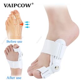 2 uds hueso grande del dedo del pie juanete férula Corrector cuidado del pie alivio del dolor Hallux Valgus plantilla ortopédica pedicura cuidado de los pies