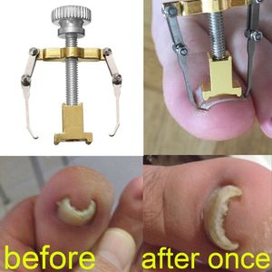 ingrown toenailコレクタートゥペディキュアフットネイルケアツールステンレスペディキュアトリートメントオニキシスバイオン補正ツール