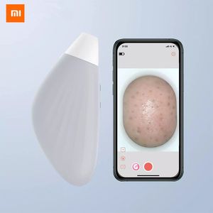 Xiaomi Visueller Mitesserentferner Mitesser Vakuumsauger Akne Saubere Poren Gesichtsschönheitswerkzeug Visueller Akneentferner Mitesser