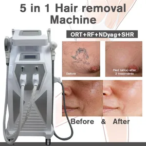 Produkt starten Laser-Tattoo-Entfernungsmaschine, multifunktionale IPL-Haarentfernungs-Schönheitsausrüstung, Akne-Behandlung, RF-Facelift-Hautpflegegeräte