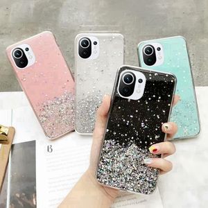 Phone Cases For Xiaomi Mi 11T Pro 11 Lite Redmi Note 10 POCO X3 Pro 10Pro 9 8 10S 9S Cover