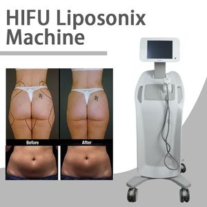 Neueste andere Schönheitsausrüstung Liposonix Ultraschall-Fettabsaugung Hifu-Körperschlankheitsmaschine mit Standardkartuschen 0,8 cm 1,3 cm Schönheitssalon