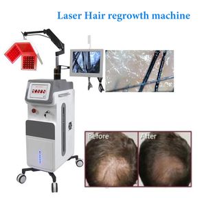 Máquinas de beleza a laser de crescimento de cabelo de penteado de crescimento de diodo de 650nm