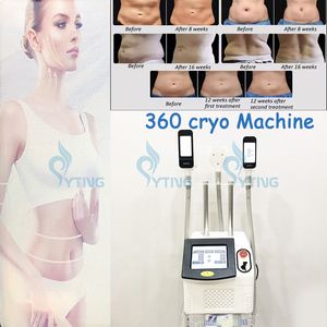 3 handtag 360 Cryolipolysis Machine Fat Freeze Body Shaping Sculpting Cellulite Reduction Dubbel Chin Borttagning