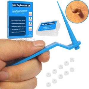 Face Care Devices Blue Set Skin Tag Removal Kit Home Use Mole Wart Remover Equipment Micro Treatment Tool Easy to Clean 0727