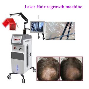 Professional High Frequency Hairs Loss Treatment Red Led Hair Growth Laser Light Therapy Restoration Machine Diode Laser Anti-hair Scalp Care Equipment Salon Use