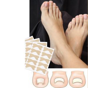 50st fotbehandling Toenail Correction Sticker Nail Ingrown Onykomykos Padding Pads Orthodontic Stickers Toe Nails Toe Clippers Package