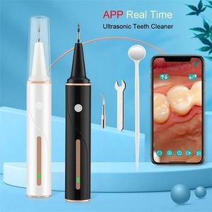 Visual Ultrasonic Teeth Cleaner Dental Electric Calculus Stain Remover Tartar Wifi LED Whitening Irrigator 220727