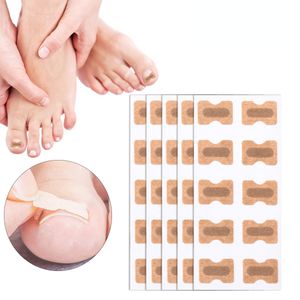 100st/Set Nail Correction Stickers Ingrown Toenail Corrector Patches Paronychia behandling Återställa korrigeringspedikyrverktyg