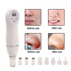 best selling TM-MD004 110-220V Diamond Blackhead Vacuum Suction remove Scars Acne Marks face Beauty device Dermabrasion Microdermabrasion home use