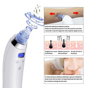 Benizim Vacuum Blackhead 리무버 얼굴 기공 클리너 Comedo Blackhead 진공 흡입 기계 Microdermoabrasion Peel Skin