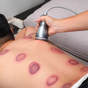 Fisioterapia Gadgets Cupping Meridian Draga Massagem Body Copos de Sucção Jarros Muscle Relax Elétrica Gua Sha Máquina Vácuo Back raspagem