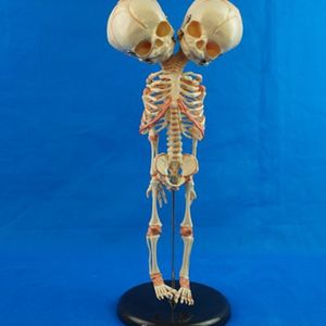14.5" OR 37cm Human New Double Head Baby Skull Skeleton Anatomical Brain Silicone Anatomy Education Model Anatomical Study Display Anatomy