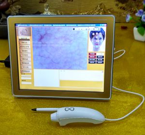 Rilevatore di umidità per la pelle digitale con display touch screen per il sistema di diagnosi della pelle