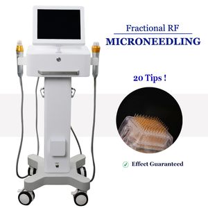 Rimozione dell'ance della macchina di bellezza Microneedle RF Le smagliature frazionarie riducono le apparecchiature per la cura della pelle con microaghi