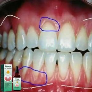 30 ml Réparation rapide des cavités Caries Mousse de dents Nettoyer Whiten Retirer les taches de plaque jaune Soulage les gencives