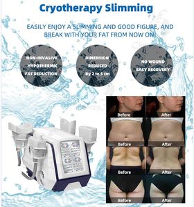 Corps professionnel de cryolipolyse de cryothérapie de refroidissement à 360 degrés amincissant la machine pour le visage, le corps, le ventre, les jambes, les bras, l'élimination de la cellulite, équipement de beauté