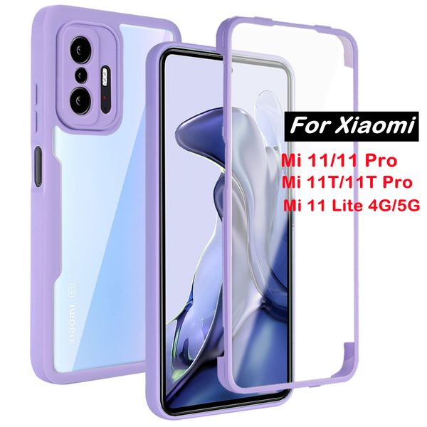 360 fundas de teléfono transparentes de doble cara para Xiaomi 11 Lite 5G Redmi 10 Pro a prueba de golpes lente de cámara pantalla protección completa parachoques cubierta